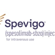 Spevigo